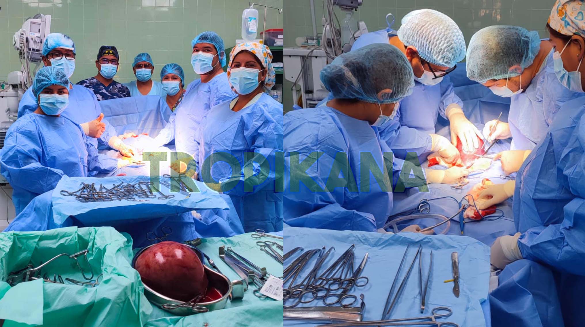 �MÃ‰DICOS DEL HOSPITAL SUB REGIONAL DE ANDAHUAYLAS OPERARON CON Ã‰XITO A MUJER CON MIOMA GIGANTE